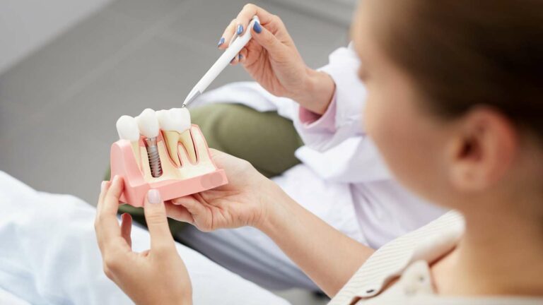 Implantes dentales en el seguro dental